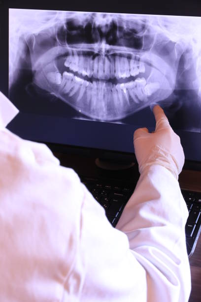 Best Emergency Treatment for Toothache in Melrose, MA